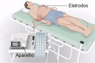 ecg Lauro de Freitas