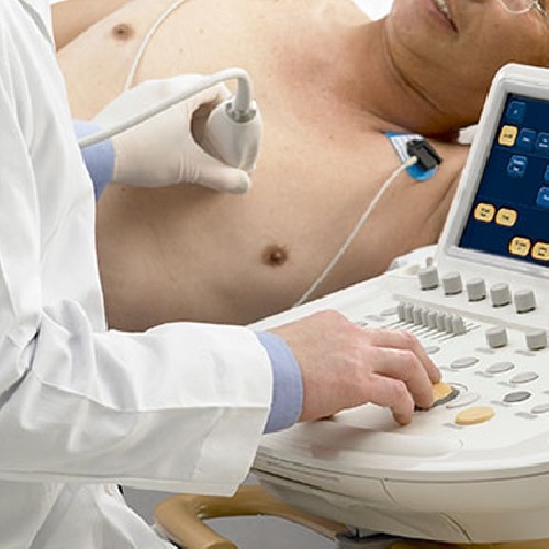 ecocardiograma ecodopplercardiogramaphd cardio lauro de freitas