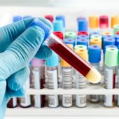 exames laboratoriais sangue fezes urina laboratório phd cardio lauro de freitas